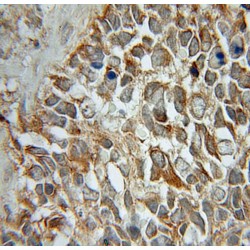 Stathmin 2 (STMN2) Antibody