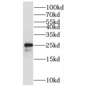 WB analysis of human brain tissue, using STMN4 antibody (1/1000 dilution).