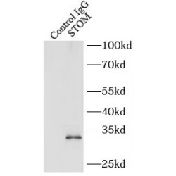 Stomatin (STOM) Antibody
