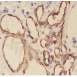 Stomatin Like 1 (STOML1) Antibody