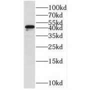 WB analysis of A375 cells, using STOML1 antibody (1/300 dilution).