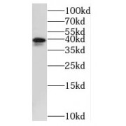 WB analysis of C6 cells, using STOML2 antibody (1/1000 dilution).