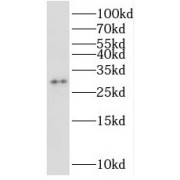 WB analysis of HeLa cells, using STOML3 antibody (1/500 dilution).