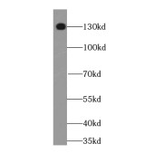 WB analysis of rat brain tissue, using STXBP5 antibody (1/300 dilution).