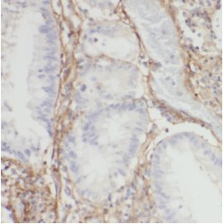 Succinate-CoA Ligase ADP-Forming Beta Subunit (SUCLA2) Antibody