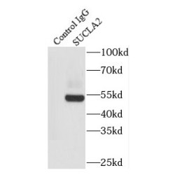 Succinate-CoA Ligase ADP-Forming Beta Subunit (SUCLA2) Antibody