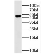WB analysis of PC-3 cells, using SUCLA2 antibody (1/500 dilution).