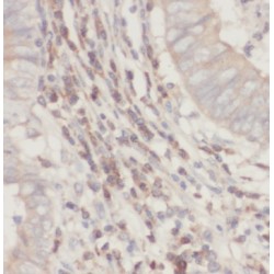 Succinate-CoA Ligase GDP-Forming Beta Subunit (SUCLG2) Antibody