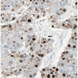SGT1 Homolog, MIS12 Kinetochore Complex Assembly Cochaperone (SUGT1) Antibody