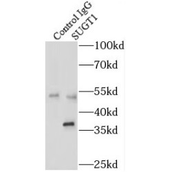 SGT1 Homolog, MIS12 Kinetochore Complex Assembly Cochaperone (SUGT1) Antibody