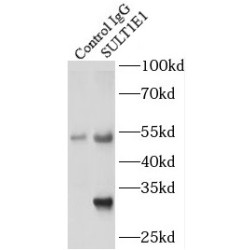 Sulfotransferase Family 1E Member 1 (SULT1E1) Antibody