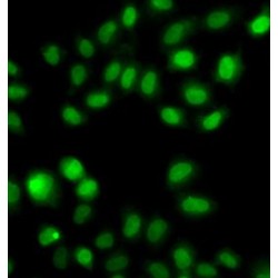 Sulfotransferase Family 2B Member 1 (SULT2B1) Antibody