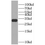 WB analysis of rat brain tissue, using SULT4A1 antibody (1/2000 dilution).