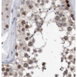 Small Ubiquitin Related Modifier Protein 1 (SUMO1) Antibody