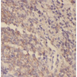Spleen Tyrosine Kinase (SYK) Antibody
