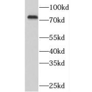 WB analysis of HEK-293 cells, using SYK antibody (1/1000 dilution).