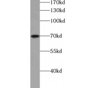 WB analysis of mouse brain tissue, using SYN1-Specific antibody (1/5000 dilution).