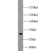 WB analysis of mouse brain tissue, using SYN2 antibody (1/2000 dilution).