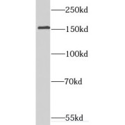 WB analysis of SH-SY5Y cells, using Synaptojanin 2 antibody (1/500 dilution).