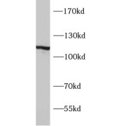 WB analysis of mouse brain tissue, using SYNPO antibody (1/1000 dilution).