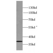 WB analysis of mouse brain tissue, using SYNPR antibody (1/800 dilution).