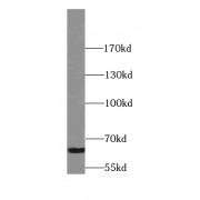 WB analysis of mouse thymus tissue, using Synaptotagmin-3 antibody (1/300 dilution).