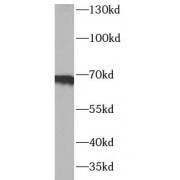 WB analysis of A549 cells, using SDC3 antibody (1/1000 dilution).