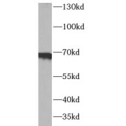 WB analysis of A549 cells, using SDC3 antibody (1/1000 dilution).