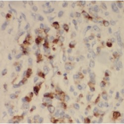 Synaptojanin-2-Binding Protein (SYNJ2BP) Antibody