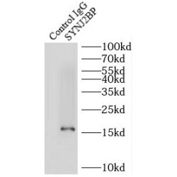 Synaptojanin-2-Binding Protein (SYNJ2BP) Antibody