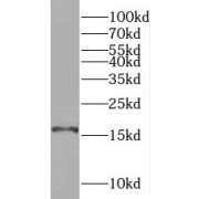 WB analysis of human heart tissue, using SYNJ2BP antibody (1/500 dilution).