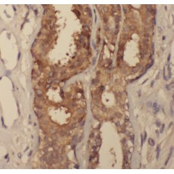 Syntenin 2 Antibody