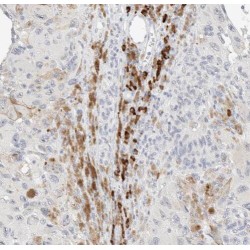 TGF-Beta-Activated Kinase 1 And MAP3K7-Binding Protein 2 (TAB2) Antibody