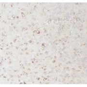 IHC-P analysis of mouse brain tissue, using TAC1 Antibody (1/200 dilution). Heat-mediated antigen retrieval was carried out with Tris-EDTA buffer, pH 9.