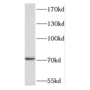 WB analysis of mouse testis tissue, using TACC2 antibody (1/500 dilution).