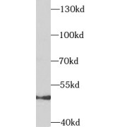 abx238472