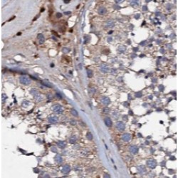 Transcriptional Adaptor 1 (TADA1L) Antibody