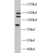 WB analysis of HeLa cells, using TAF3 antibody (1/500 dilution).