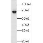 WB analysis of Jurkat cells, using TAF5L antibody (1/500 dilution).