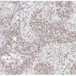 TATA-Box Binding Protein Associated Factor 7 (TAF7) Antibody