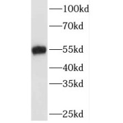 WB analysis of Jurkat cells, using TAF7 antibody (1/500 dilution).