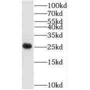 WB analysis of HeLa cells, using TAF9 antibody (1/1000 dilution).