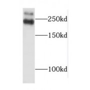 WB analysis of HeLa cells, using TLN1 antibody (1/500 dilution).