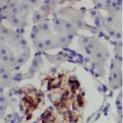 Tax1 Binding Protein 3 (TAX1BP3) Antibody