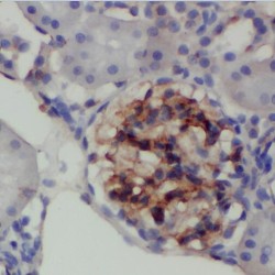 TBC1 Domain Family Member 22A (TBC1D22A) Antibody