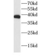 WB analysis of HeLa cells, using TBP antibody (1/4000 dilution).
