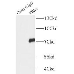 T-Box, Brain 1 (TBR1) Antibody