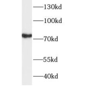 WB analysis of mouse brain tissue, using TBR1 antibody (1/1000 dilution).