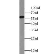 WB analysis of A549 cells, using TBXAS1 antibody (1/1000 dilution).