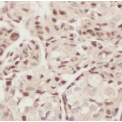 Transcription Elongation Factor B Subunit 1 (TCEB1) Antibody